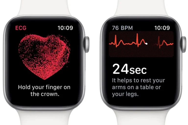 Apple Watch toont waarde bij opvolging hartpatiënten na operatie